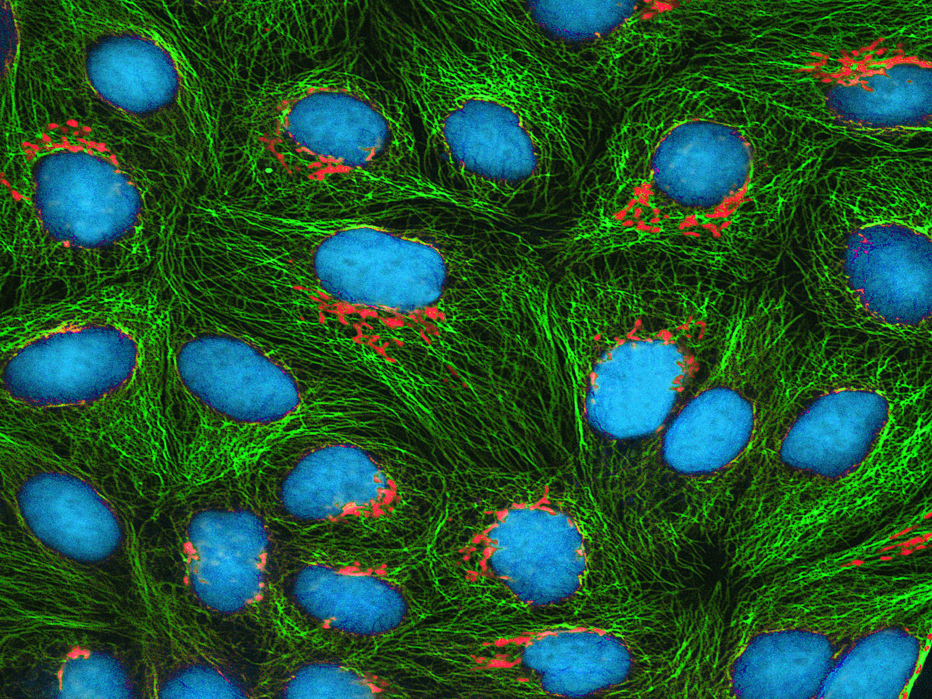 An image of HeLa cells, a human cell line used for research, as seen under an electron microscope. Image created by Thomas Deerinck.