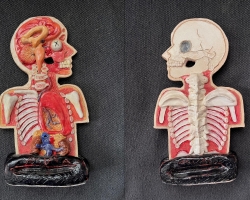 aguas fragile anatomy