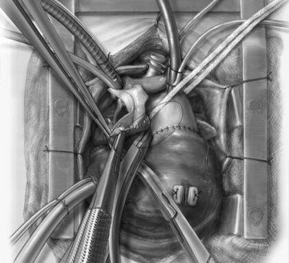 Art Faculty Exhibition Piece